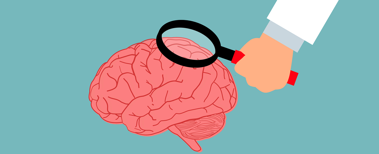Unit test the brains and not the nerves